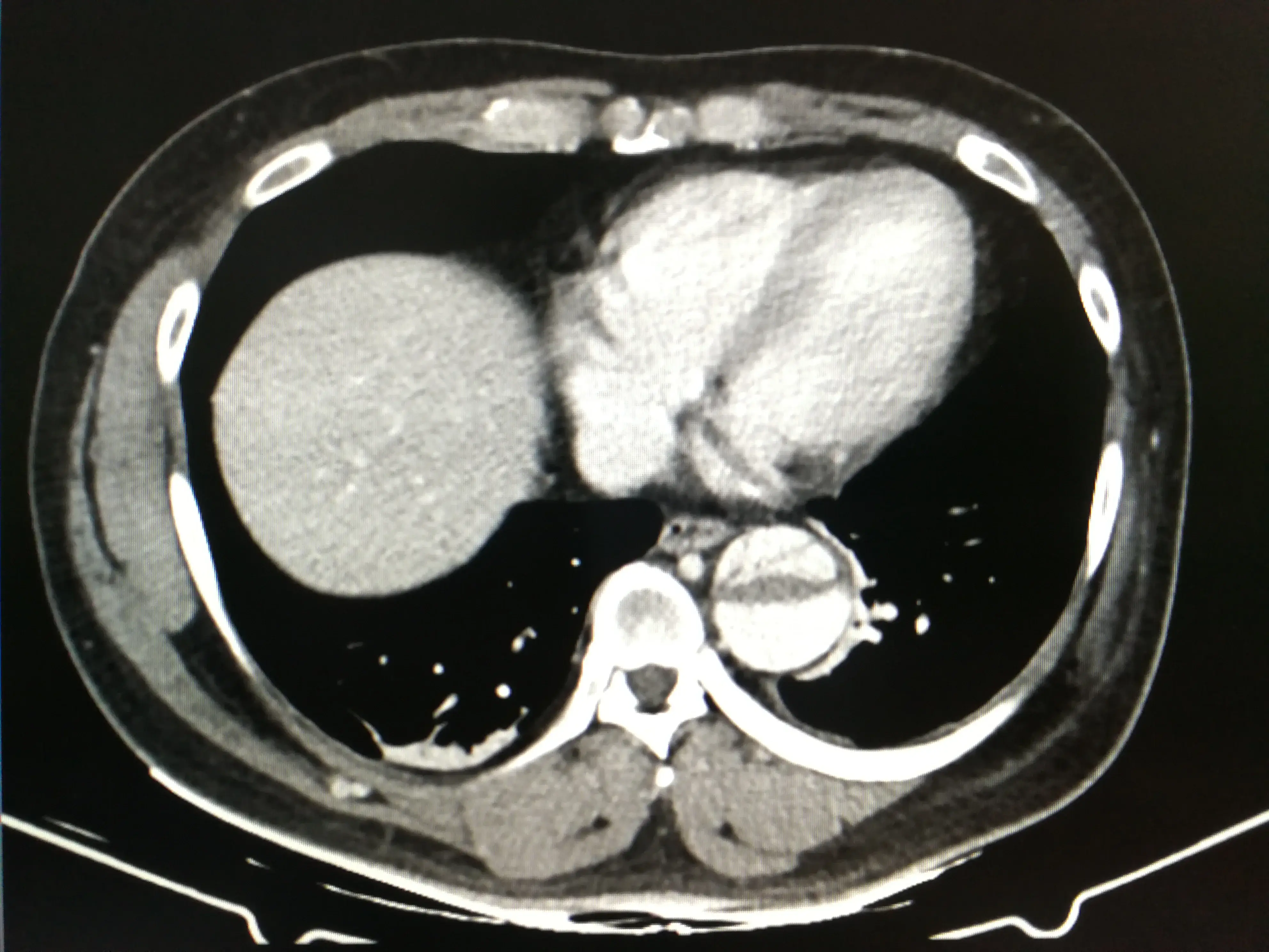 Cardiac Computed Tomography | https://www.harleystreet.sg/