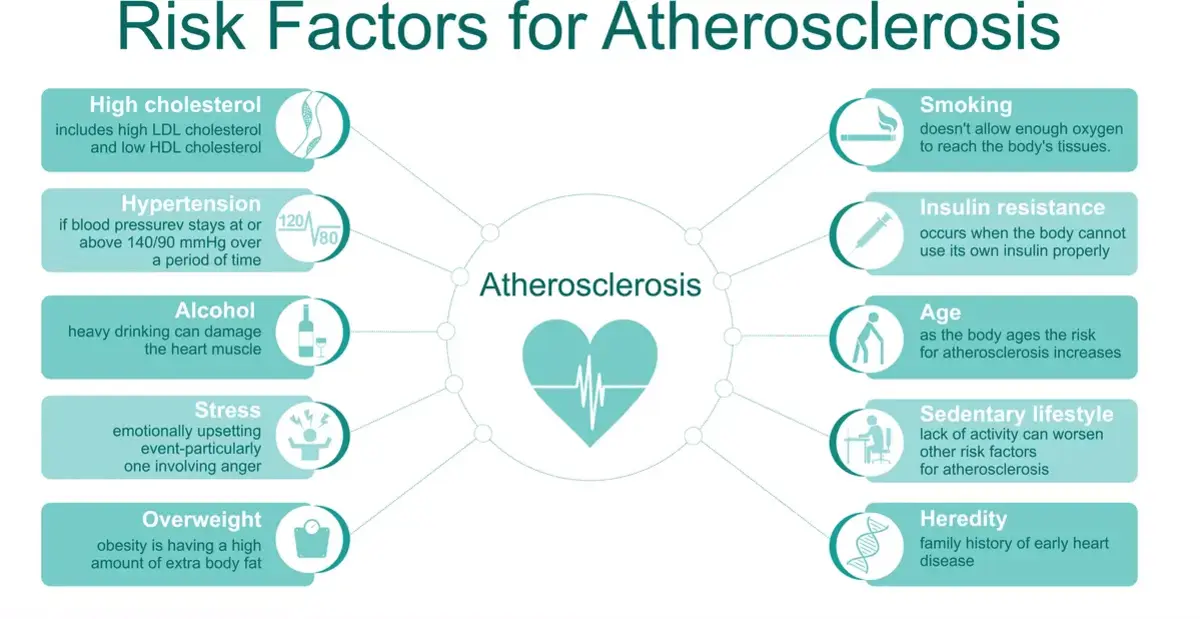 Causes and Risk Factors of Atherosclerosis | https://www.harleystreet.sg/