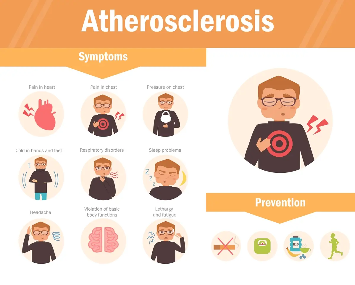 Symptoms of Atherosclerosis | https://www.harleystreet.sg/