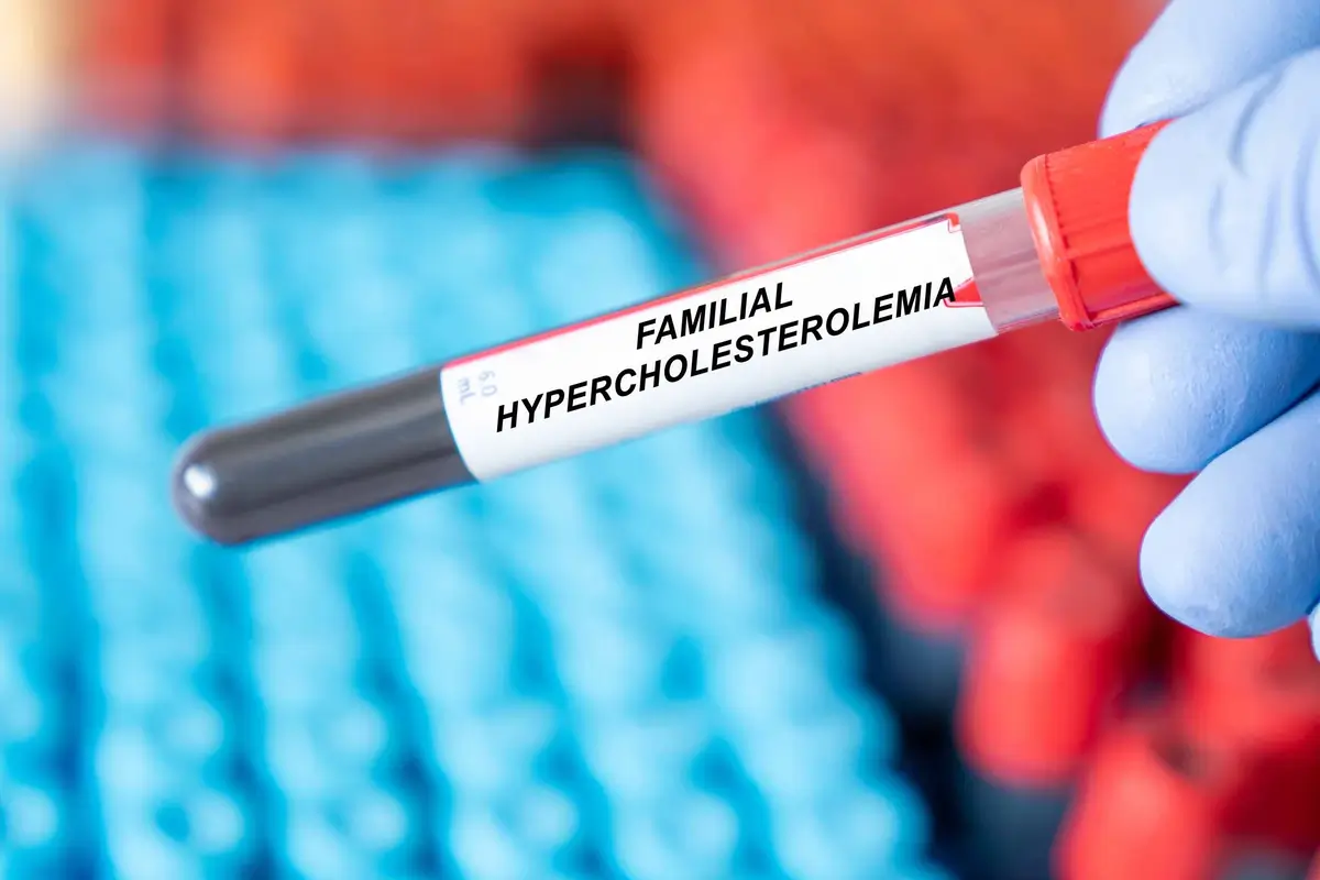 People with Familial Hypercholesterolemia (FH) | https://www.harleystreet.sg/