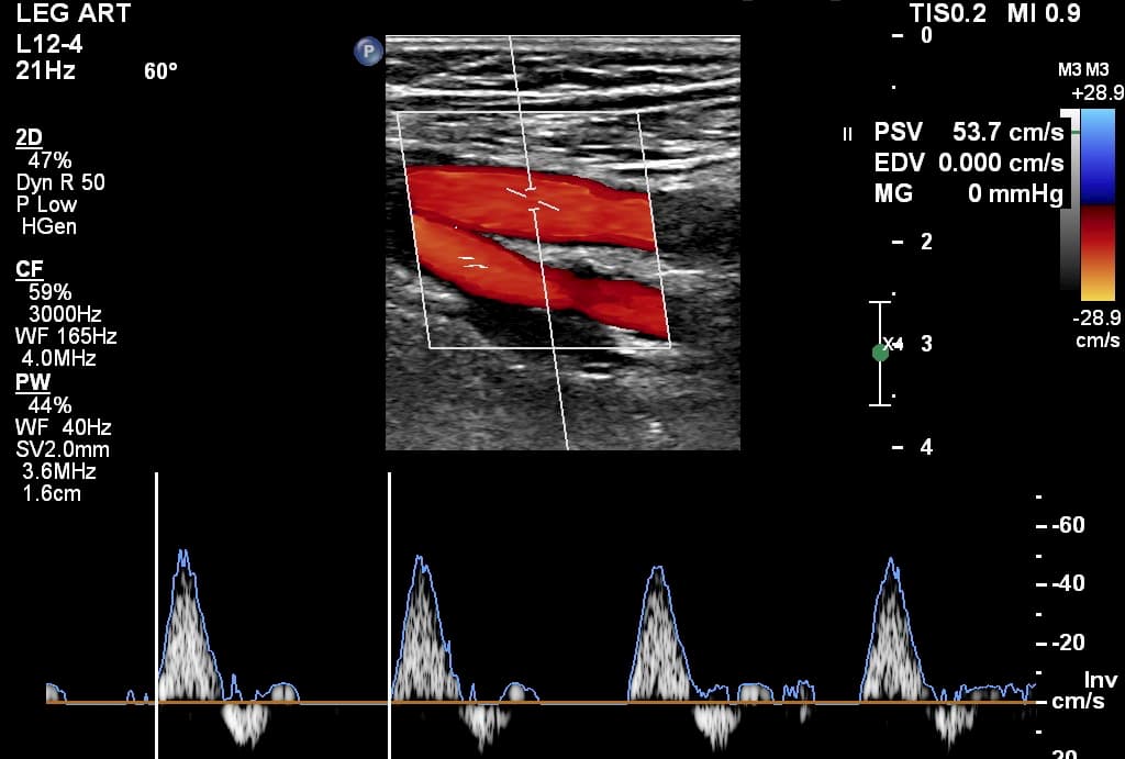 Arterial Diagnostics