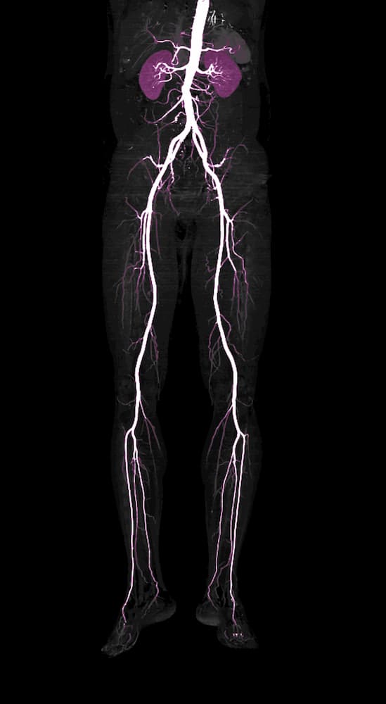 Arterial and Aortic Interventions