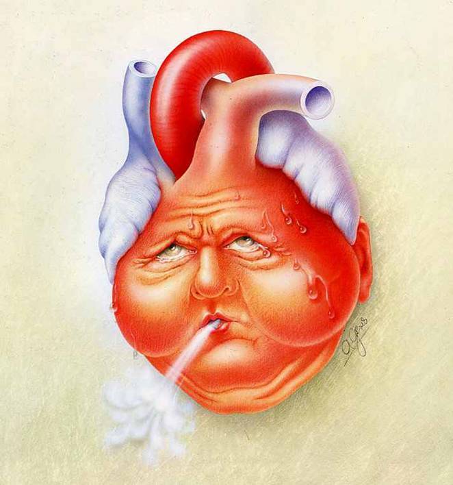 A Global Health Pandemic: What is Heart Failure?