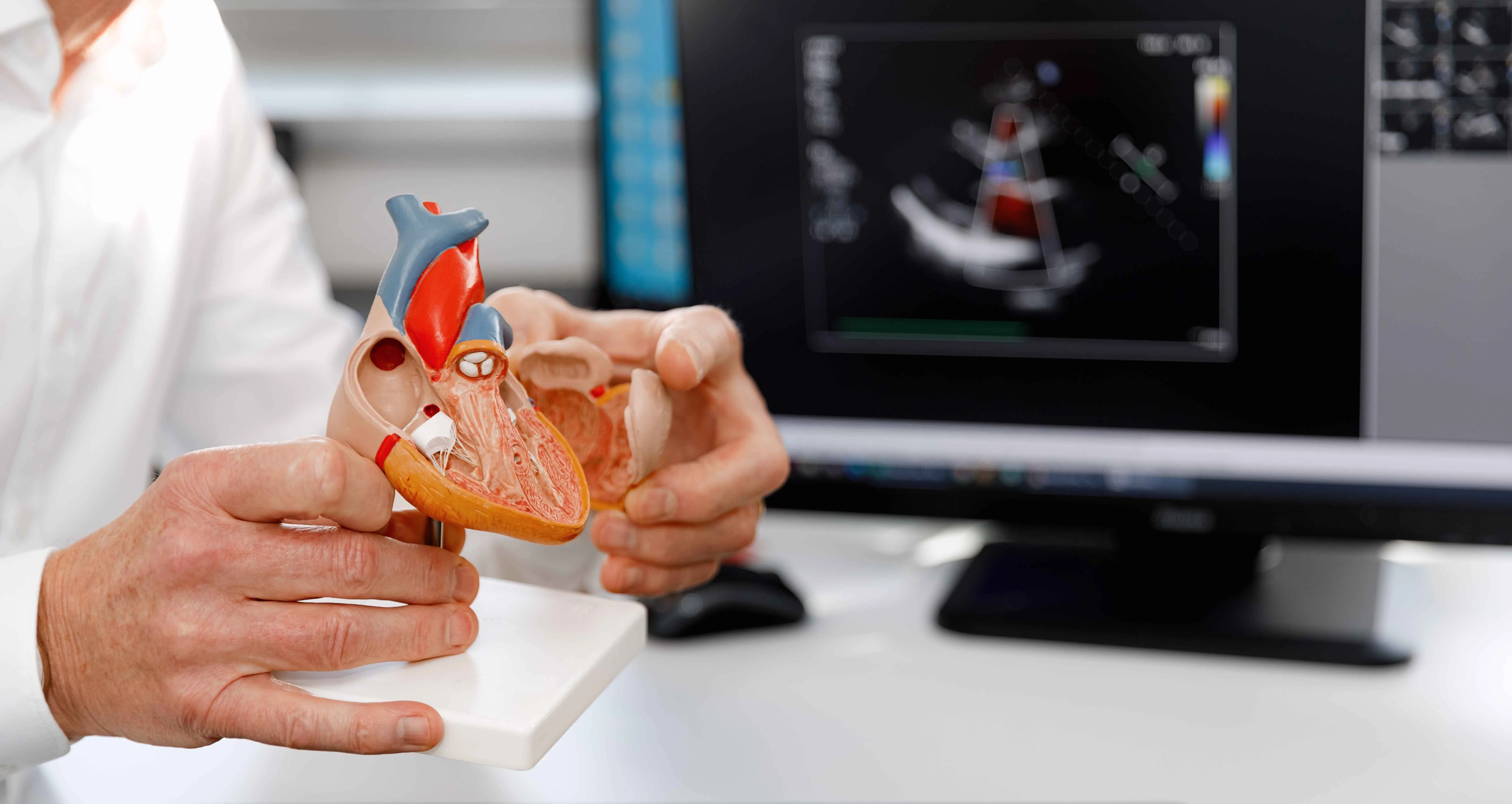 Atrioventricular Septal Defect | https://www.harleystreet.sg/
