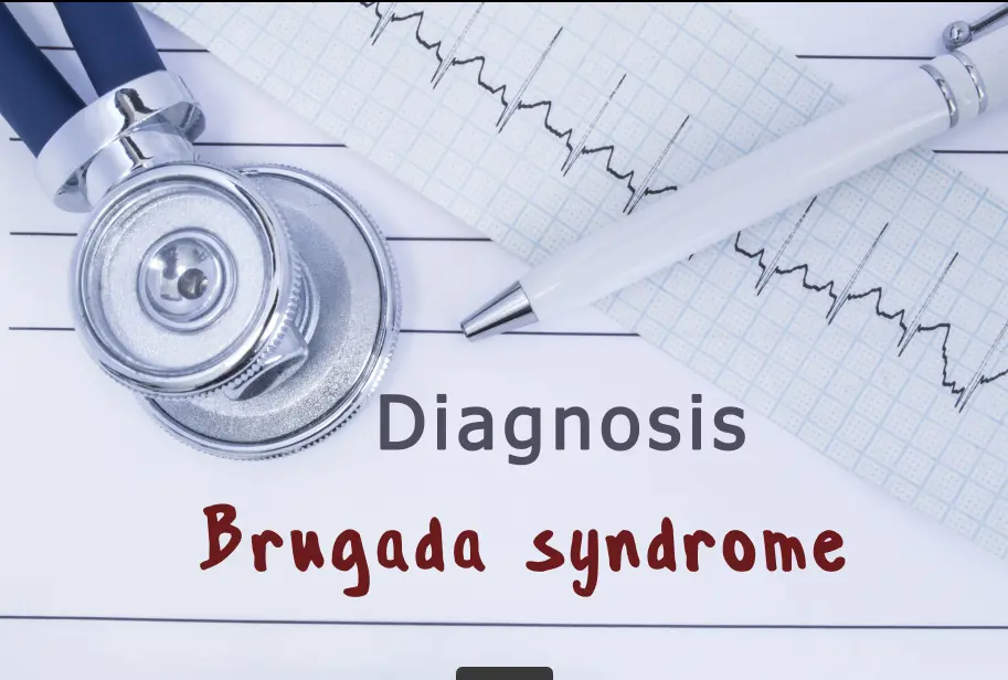 Brugada Syndrome | https://www.harleystreet.sg/