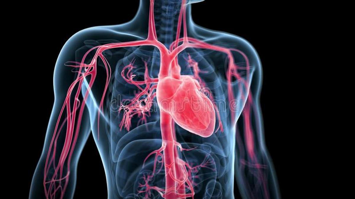 Coronary Angiography