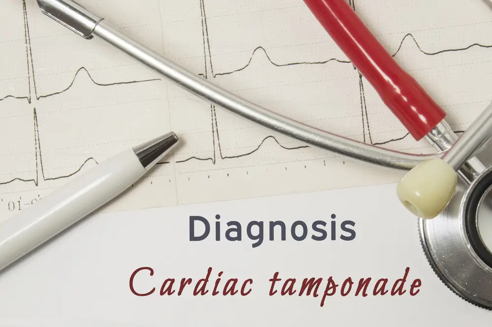 Diagnosis of Cardiac tamponade | https://www.harleystreet.sg/
