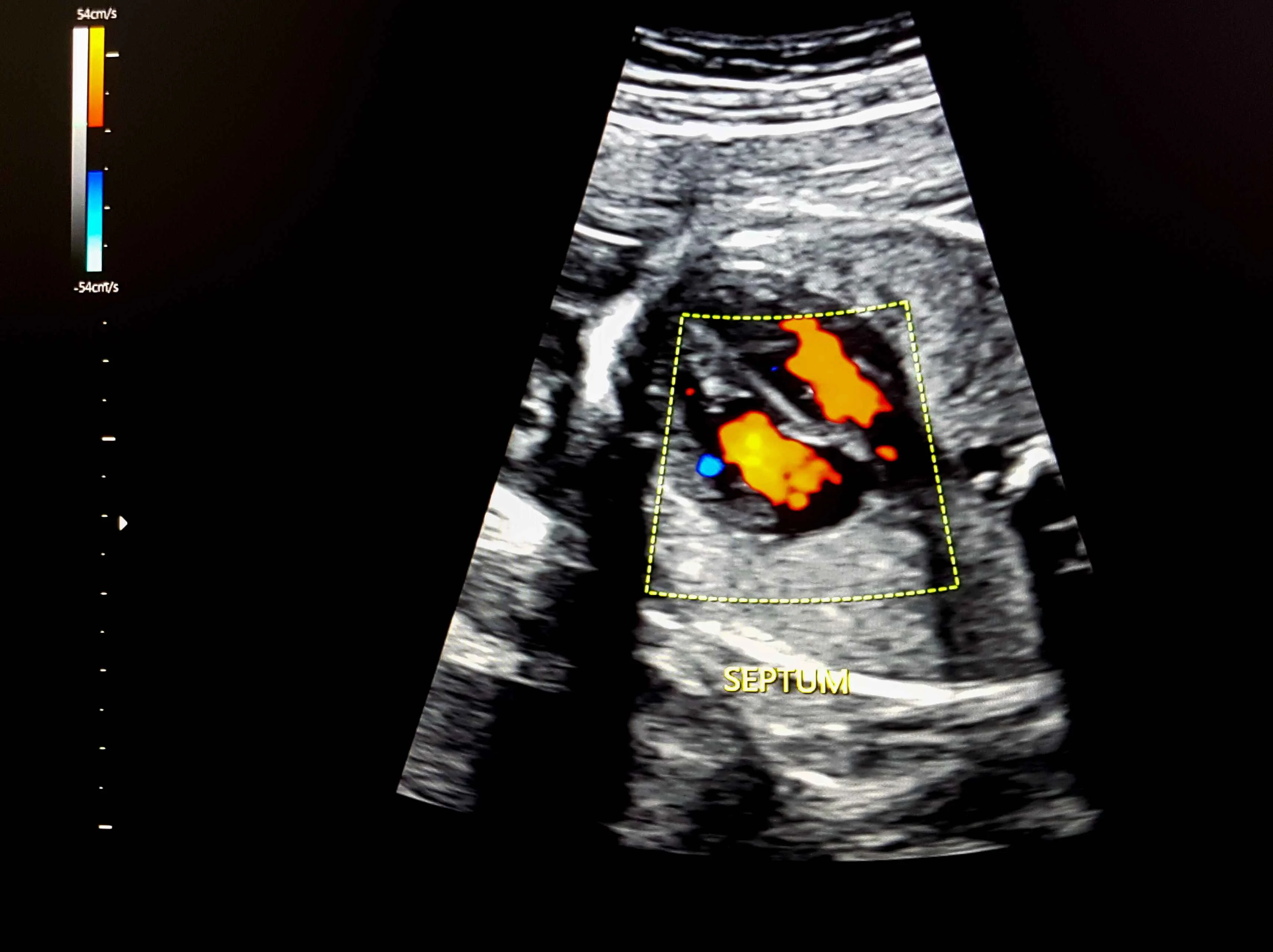 Fetal Echocardiography |https://www.harleystreet.sg/