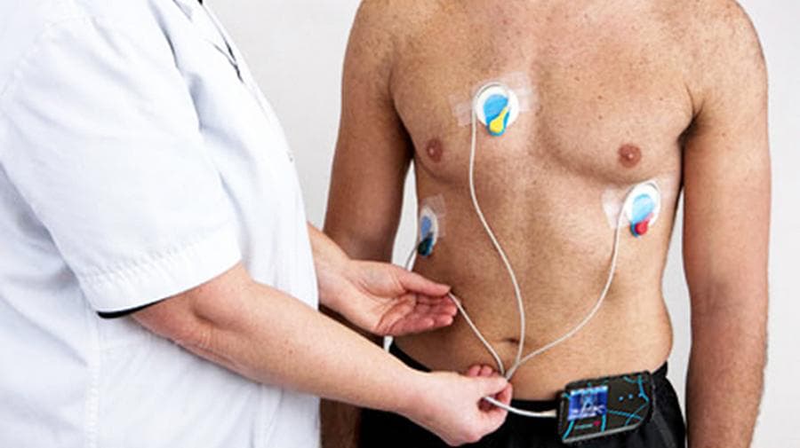 Holter monitor - Mayo Clinic