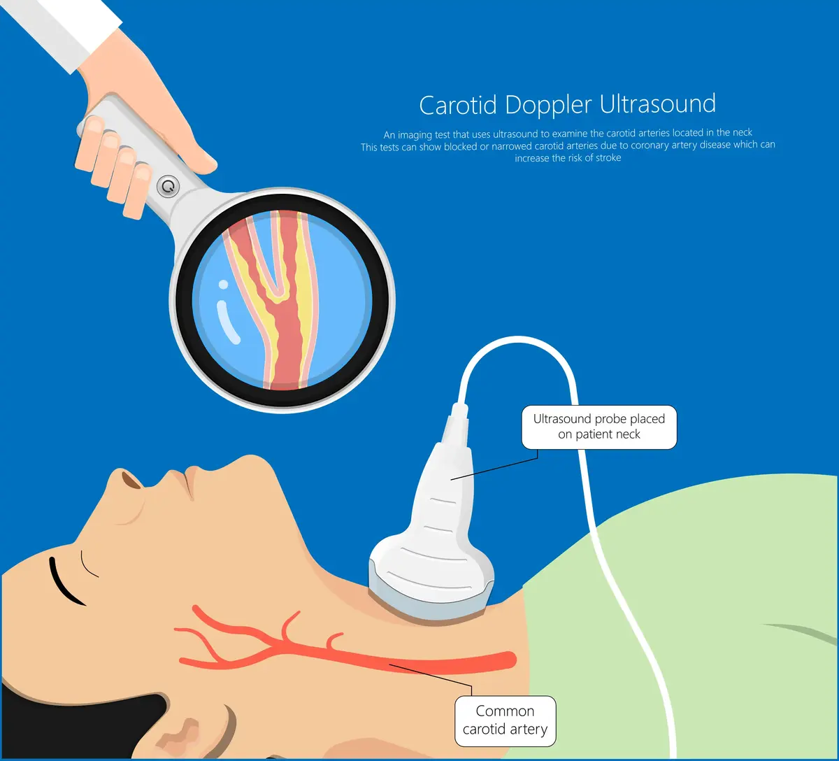 Carotid Ultrasound | https://www.harleystreet.sg/