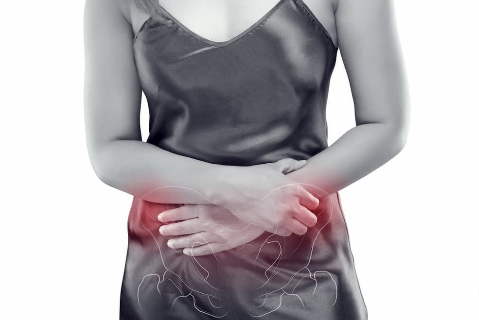 Pelvic Congestion Syndrome and Chronic Pelvic Pain