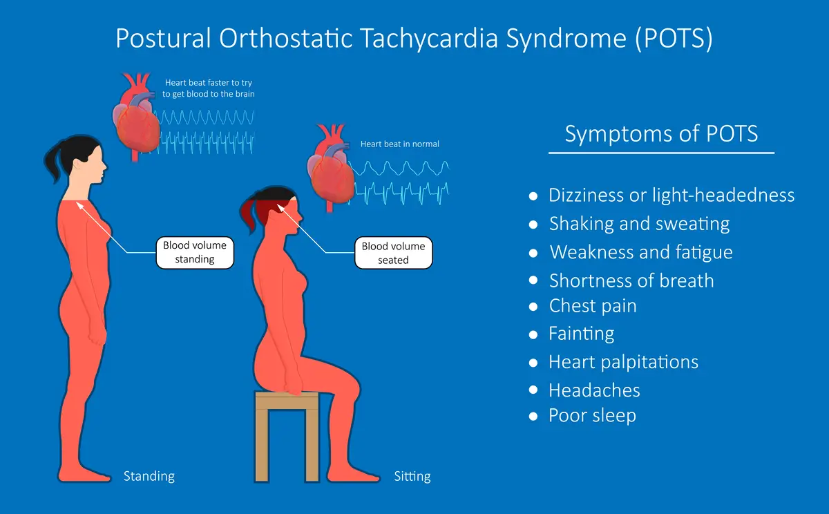 Tilt Table Test Can Be Used to Diagnose Syndrome of Postural Orthostatic Tachycardia | https://www.harleystreet.sg/