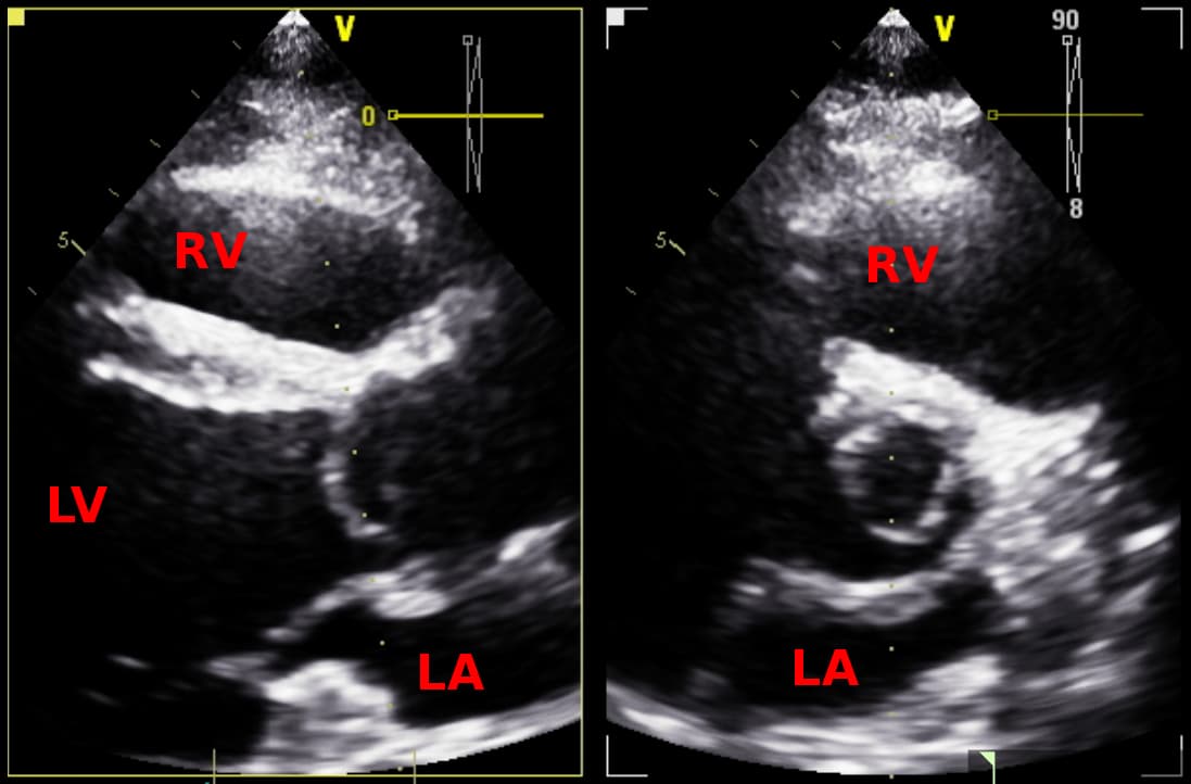 Quiz Echo Image