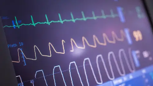 The Role of ECG in Diagnosing Tachycardia | https://www.harleystreet.sg/